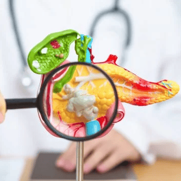 Pancreatitis aguda. La importancia de un diagnóstico temprano para evitar complicaciones. oncocir clínica de ginecología y cirugía general en Madrid oncocir clínica de ginecología y cirugía general en Madrid